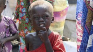 Over 1 million youngsters in South Sudan susceptible to loss of life from intense acute malnutrition
